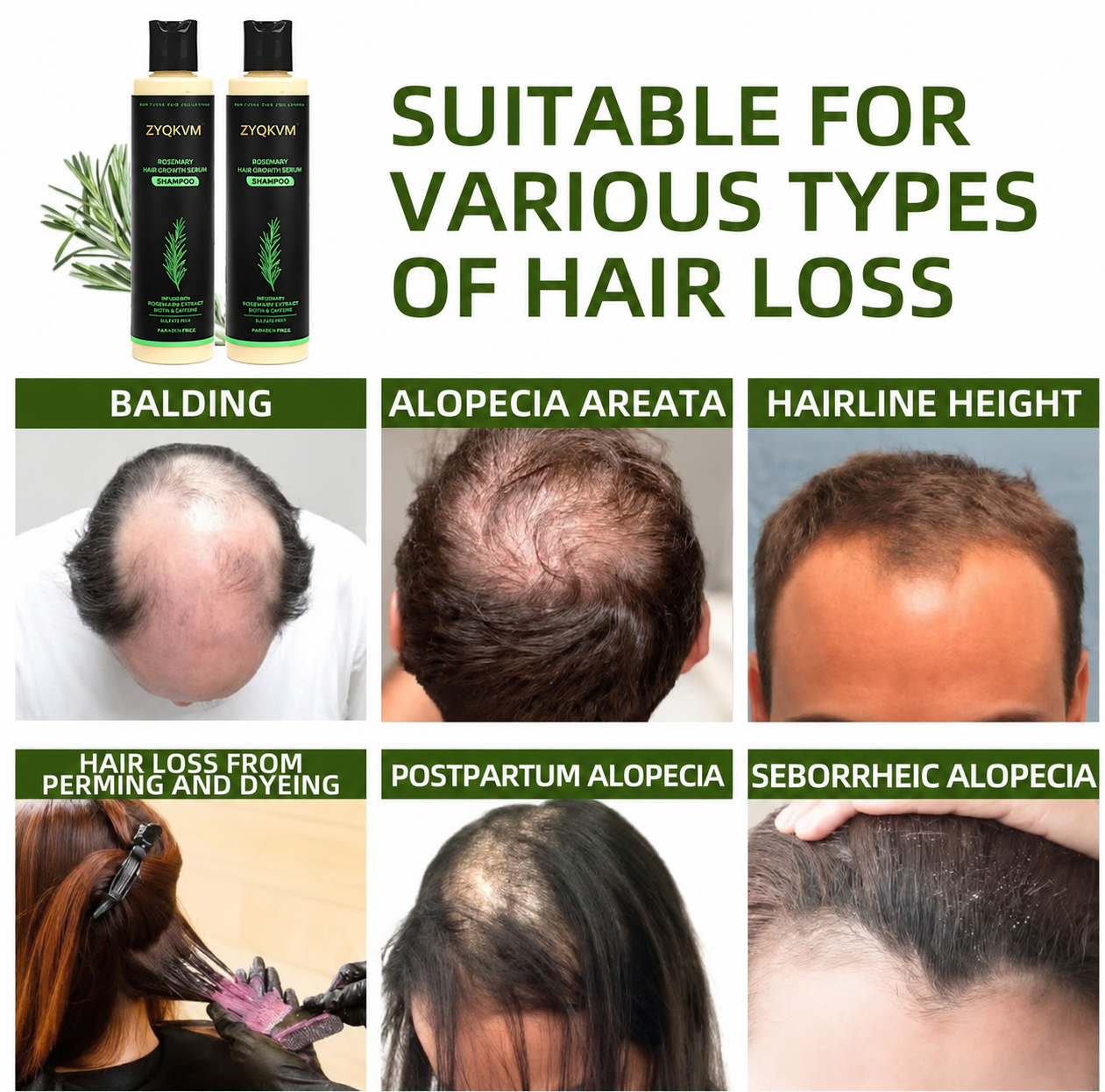 🔥LAST DAY 50% OFF - 🌿ZYQKVM® Organic Rosemary Hair Growth Shampoo
