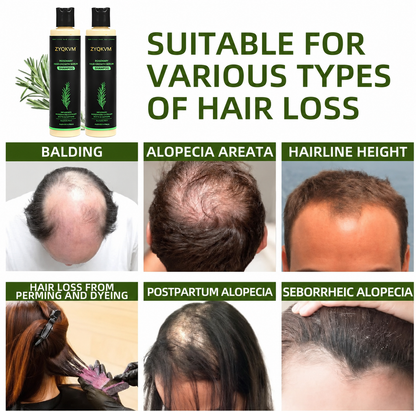 🔥LAST DAY 50% OFF - 🌿ZYQKVM® Organic Rosemary Hair Growth Shampoo