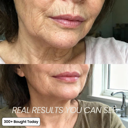 ZYQKVM  Korean Pink Collagen Glow Volume Multi Balm 🔥LAST DAY 60% OFF