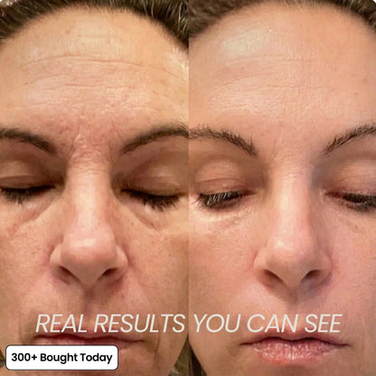 ZYQKVM  Korean Pink Collagen Glow Volume Multi Balm 🔥LAST DAY 60% OFF