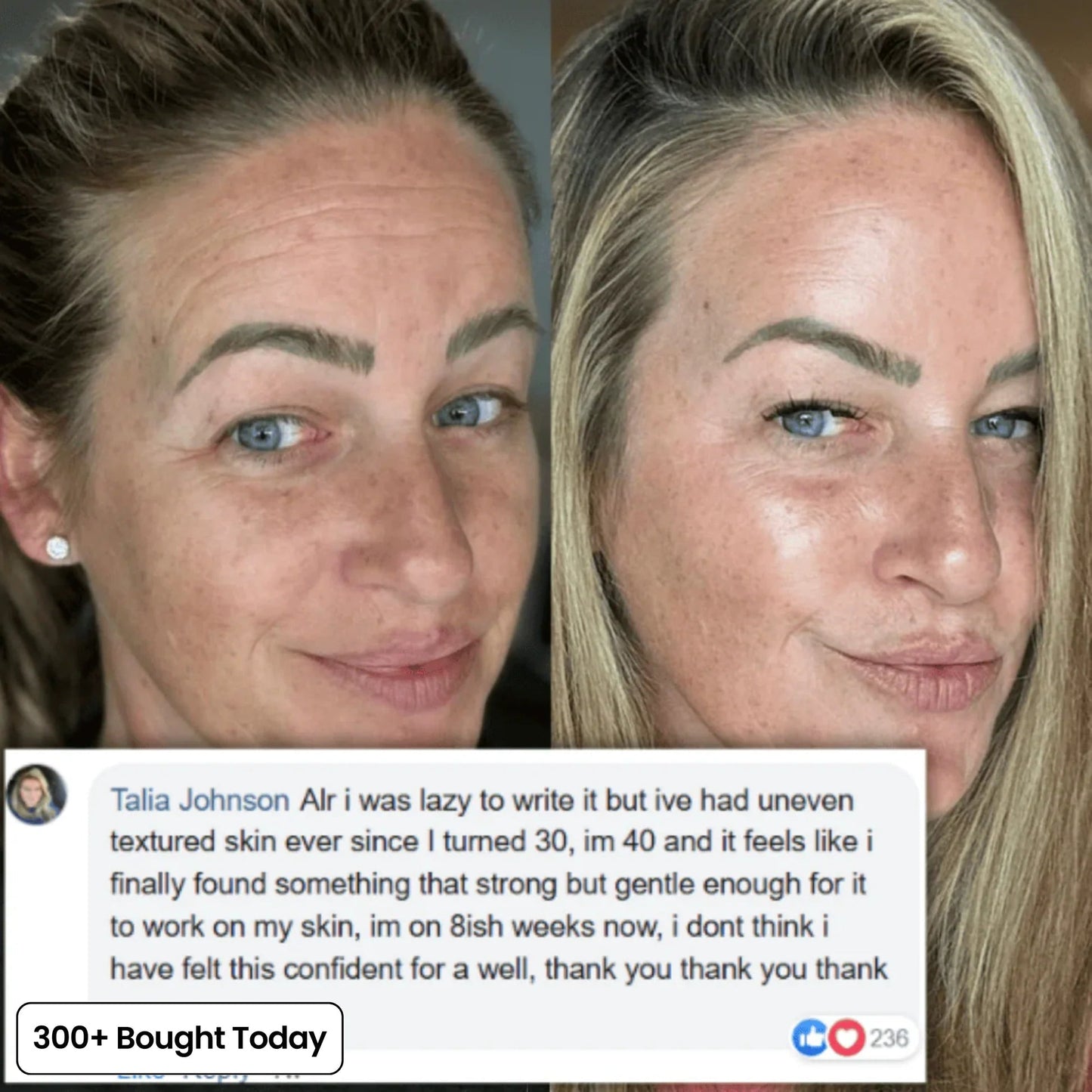 ZYQKVM  Korean Pink Collagen Glow Volume Multi Balm 🔥LAST DAY 60% OFF