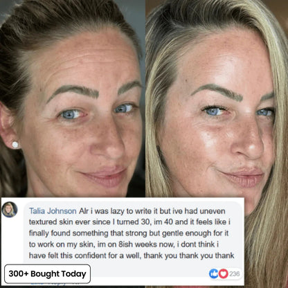 ZYQKVM  Korean Pink Collagen Glow Volume Multi Balm 🔥LAST DAY 60% OFF