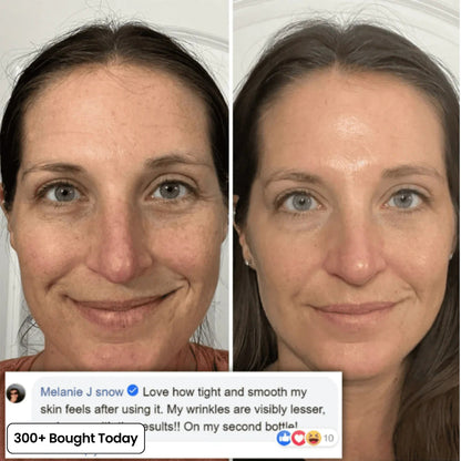 ZYQKVM  Korean Pink Collagen Glow Volume Multi Balm 🔥LAST DAY 60% OFF