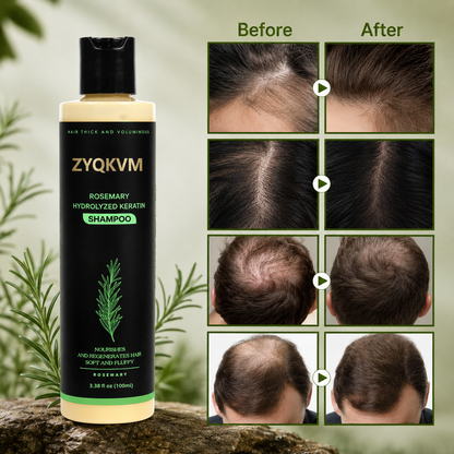 🔥LAST DAY 50% OFF - 🌿ZYQKVM® Organic Rosemary Hair Growth Shampoo