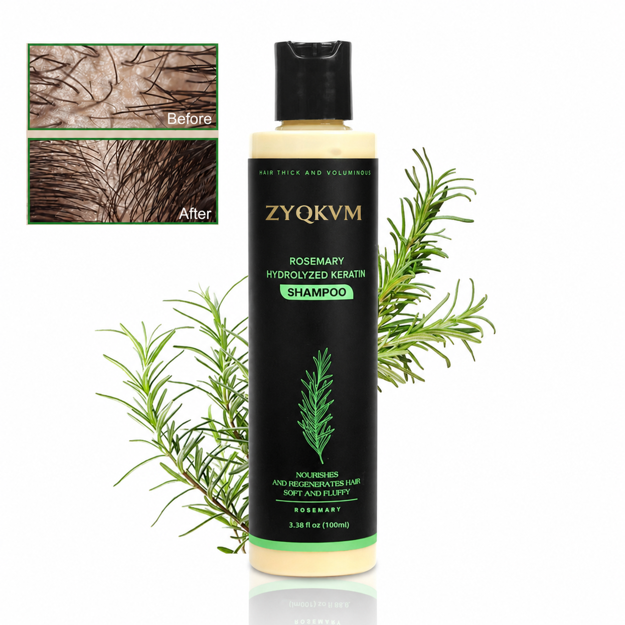 🔥LAST DAY 50% OFF - 🌿ZYQKVM® Organic Rosemary Hair Growth Shampoo