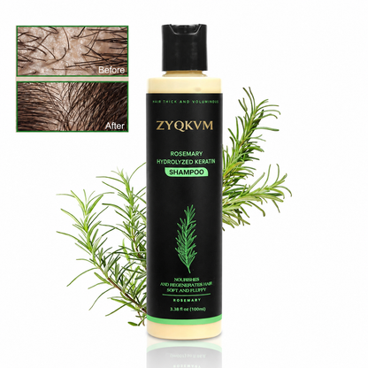 🔥LAST DAY 50% OFF - 🌿ZYQKVM® Organic Rosemary Hair Growth Shampoo