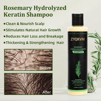 🔥LAST DAY 50% OFF - 🌿ZYQKVM® Organic Rosemary Hair Growth Shampoo